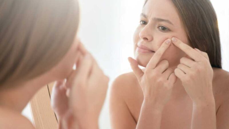 Clear Skin Ahead: How Acne Treatment Systems Can Transform Your Complexion